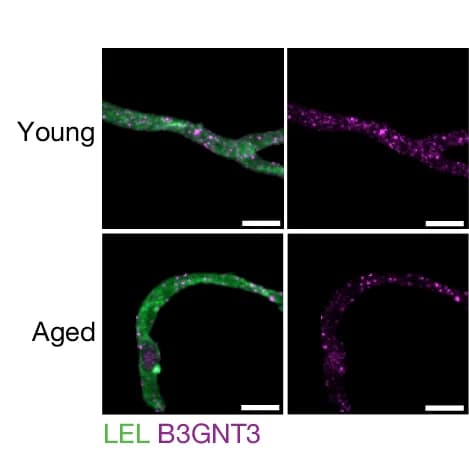 Open access visualization of Microscopy, B3GNT3 Expression, Microvessels, LEL