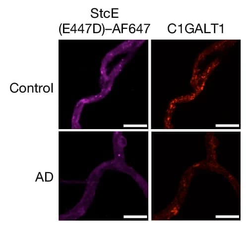 Open access visualization of Microscopy, C1GALT1, Mucin-Domain Glycoprotein, Microvessels, Alzheimers Disease
