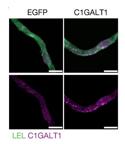 Open access visualization of Microscopy, C1GALT1, Microvessels, LEL, Expression