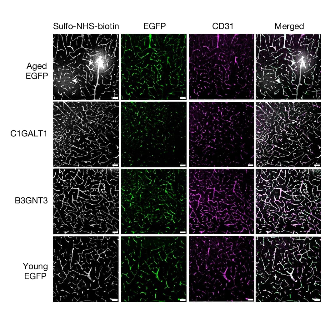 Open access visualization of Microscopy, Sulfo-NHS-biotin, Leakage, EGFP, Cortical Vessels