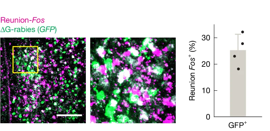Open access visualization of Microscopy, Bar Plot, Error Bars, MPN Reunion Neurons, MPN Isolation Neurons