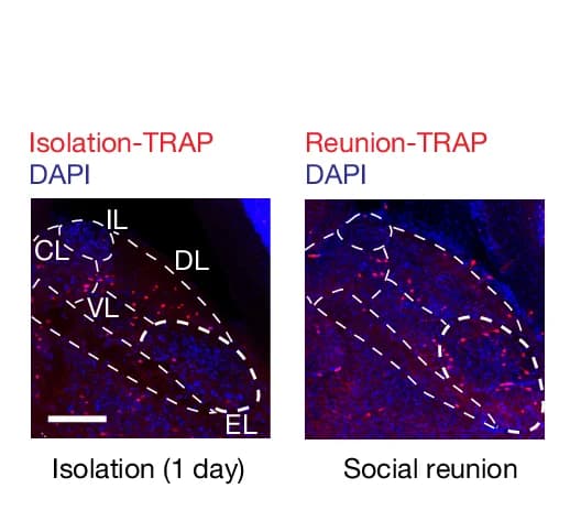 Open access visualization of Microscopy, Neuronal Activity, PBN Subnuclei, Social Isolation, Social Reunion