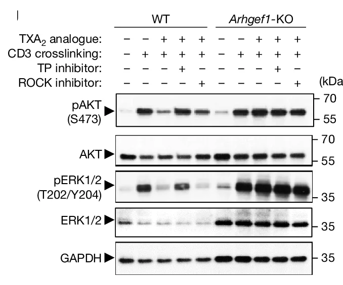 Open access visualization of Gel, AKT Phosphorylation, ERK Phosphorylation, Wild-Type OT-1 CD8+ T Cells, Arhgef1-Deficient OT-1 CD8+ T Cells
