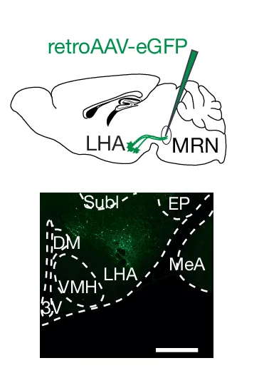 Open access visualization of Microscopy, Illustration, Retrograde Tracing, MRN, retroAAV