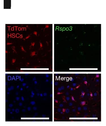 Open access visualization of Microscopy, RNAscope Analysis, Rspo3 Colocalization, TdTom + HSCs, Mouse Livers