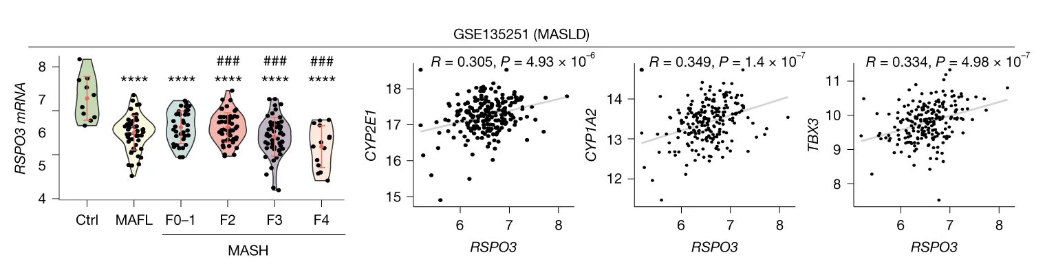 Open access visualization of Violin Plot, Scatter Plot, Regression Plot, RSPO3 mRNA, MASLD Stages