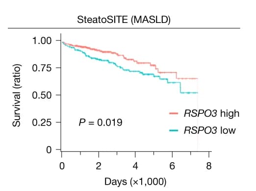 Open access visualization of Survival Curve, Line Plot, Survival Analysis, RSPO3 Expression, SteatoSITE MASLD Cohort
