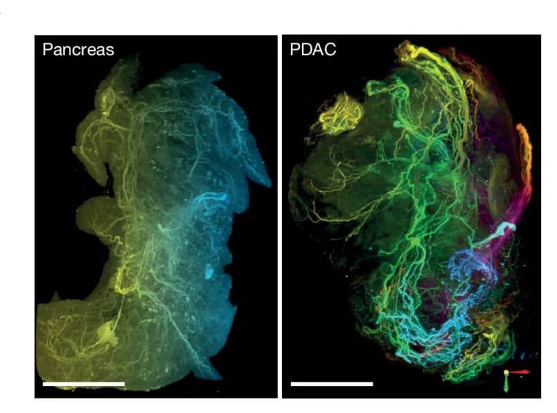 Open access visualization of Microscopy, PRPH, Pancreas, Tumor Innervation, LSFM