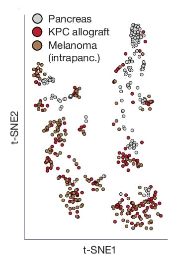 Open access visualization of Scatter Plot, UMAP, PCA, t-SNE, Pancreas