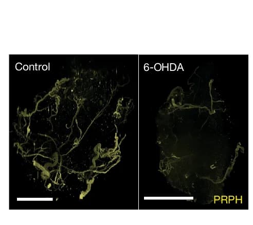 Open access visualization of Microscopy, PRPH Staining, LSFM Imaging, Control PDAC, Denervated Tumours