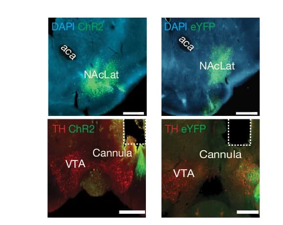 Open access visualization of Microscopy, Fluorescence Images, ChR2 Expression, eYFP Expression, NAcLat