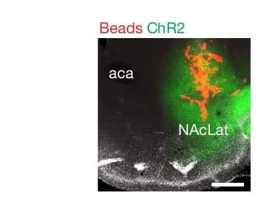 Open access visualization of Microscopy, Fluorescent Retrobeads, ChR2 Expression, NAcLat
