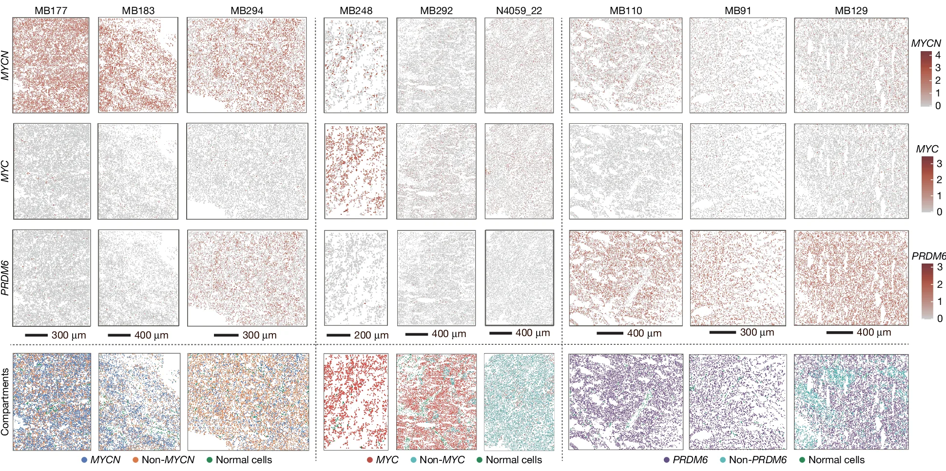 Open access visualization of Microscopy, Spatial Gene Expression, MYC, MYCN, PRDM6