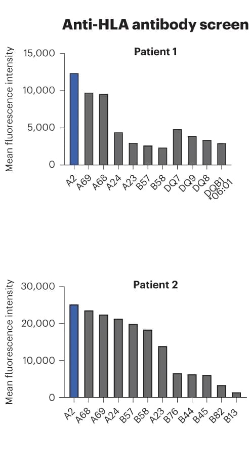 Open access visualization of Bar Plot, Single Antigen Bead Assay, HLA Class I Antibodies, HLA Class II Antibodies, Transplant Recipients