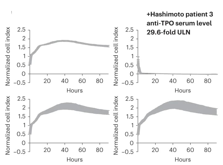 Open access visualization of Line Plot, Error Bars, Thyroid Cells, Hashimoto's Disease, Serum