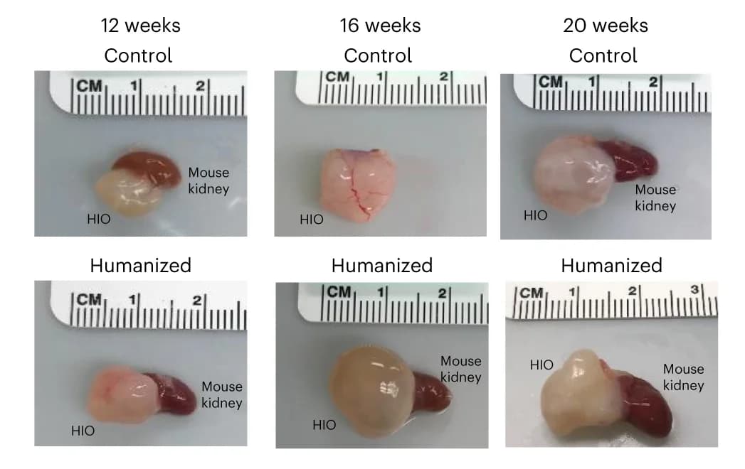 Open access visualization of Photo, HIO, Mouse Kidney, Control Mice, Humanized Mice