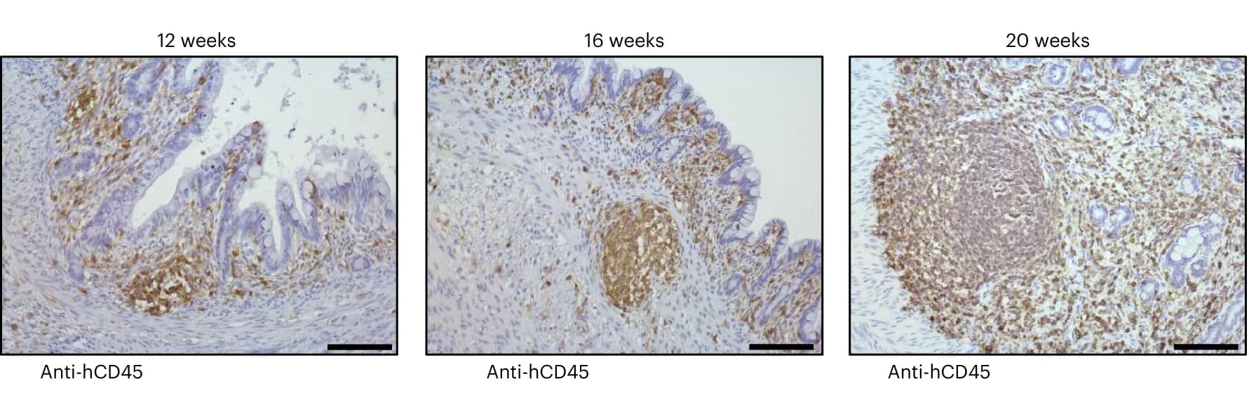 Open access visualization of Microscopy, HIO, IHC, CD45 Antibody