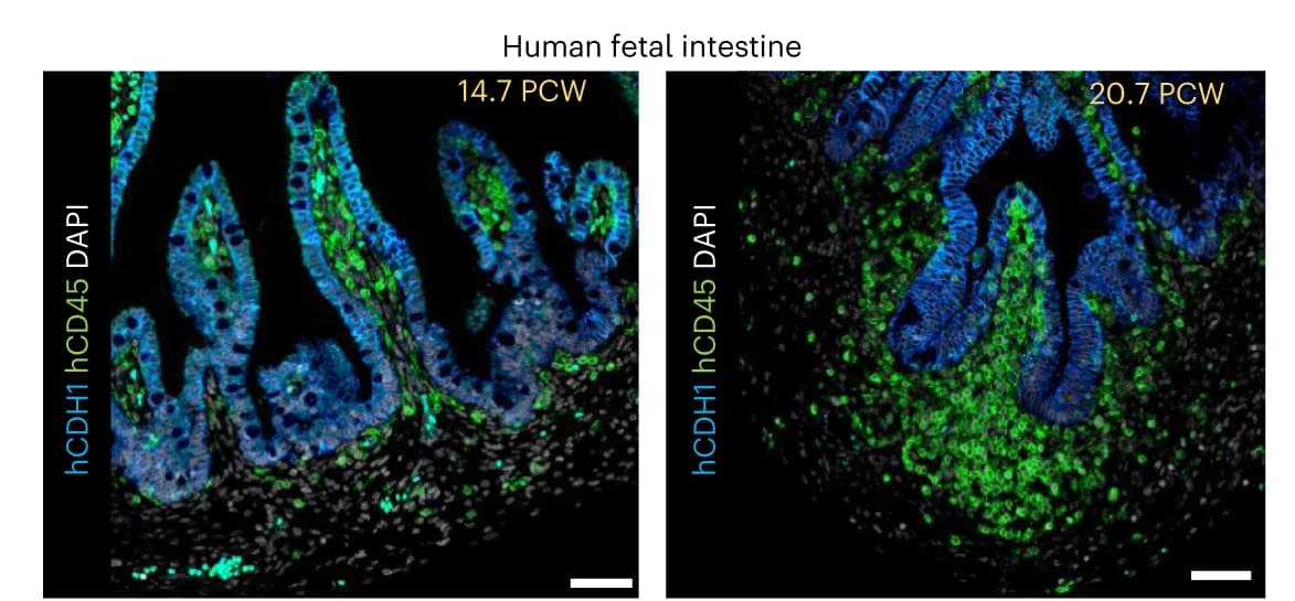 Open access visualization of Microscopy, Human Fetal Intestine, Immunofluorescence, CDH1, CD45 Antibodies