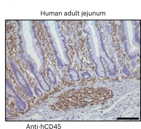 Open access visualization of Microscopy, Human Adult Jejunum, IHC, CD45 Antibody
