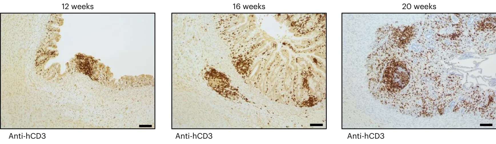 Open access visualization of Microscopy, T Cells, HIO, Transplantation