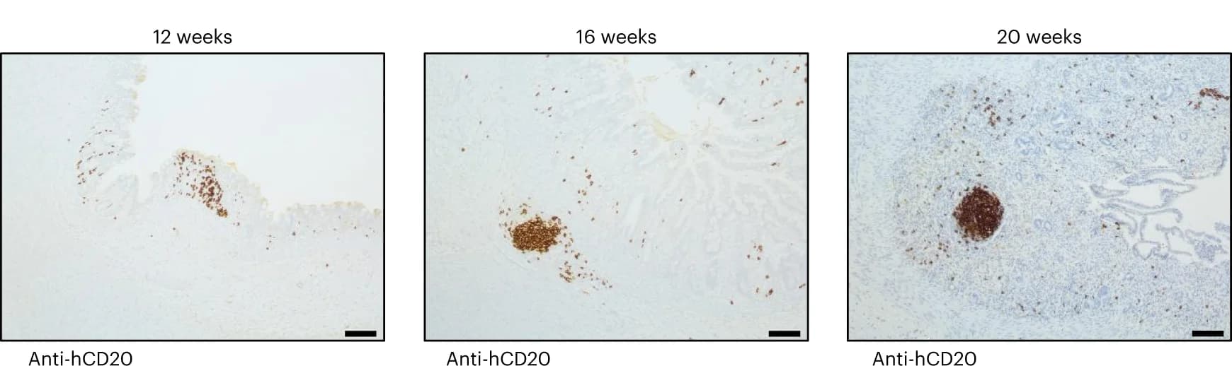 Open access visualization of Microscopy, B Cells, HIO, Transplantation