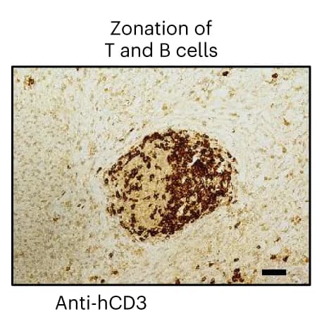 Open access visualization of Microscopy, HIO, Fetal gut, B Cells, CD20