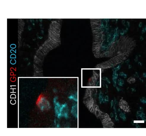 Open access visualization of Microscopy, CDH1, GP2, CD20, HIO