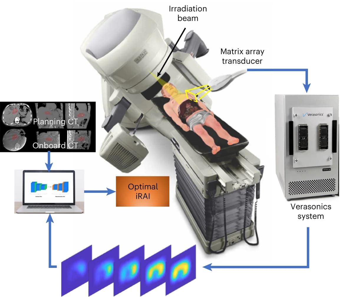 Open access visualization of Workflow, Illustration, iRAI System, Dose Deposition, Radiotherapy