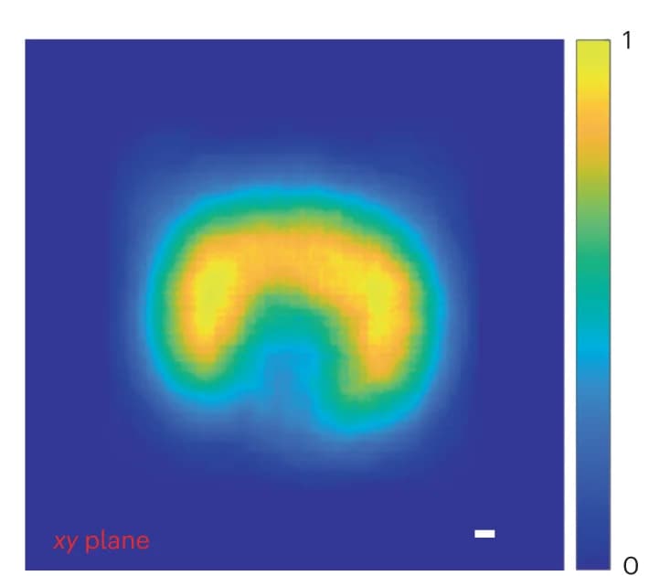 Open access visualization of Heatmap, iRAI Imaging, Relative Deposited Dose, C-shaped Dose Distribution Treatment Plan
