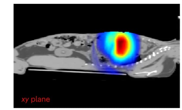 Open access visualization of Microscopy, iRAI Image, Dose Distribution, CT Scan