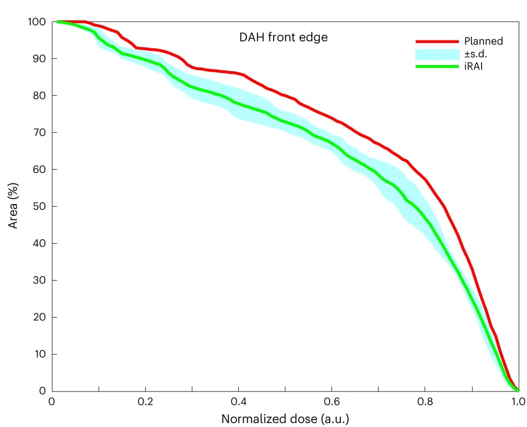Open access visualization of Line Plot, Error Bars, DVH, iRAI Measurement, Front Edge