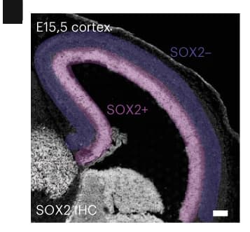 Open access visualization of Microscopy, SOX2, Immunostaining, E15.5, Spatial ATAC