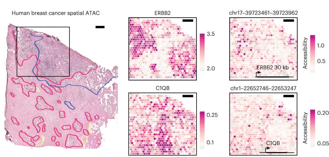 Open access visualization of Microscopy, Heatmap, Hematoxylin and eosin, Spatial ATAC, ERBB2 locus