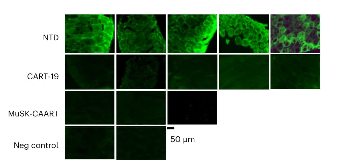 Open access visualization of Microscopy, Immunofluorescence, Diaphragm Muscle, IgG, MuSK