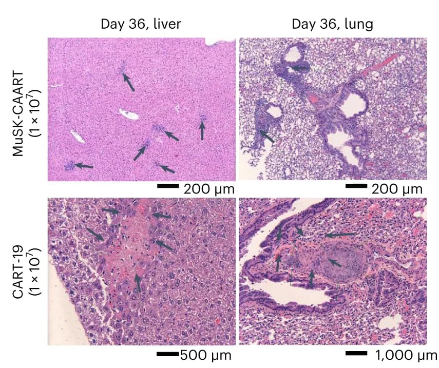Open access visualization of Microscopy, Liver, Lung, MuSK-CAART, CART-19