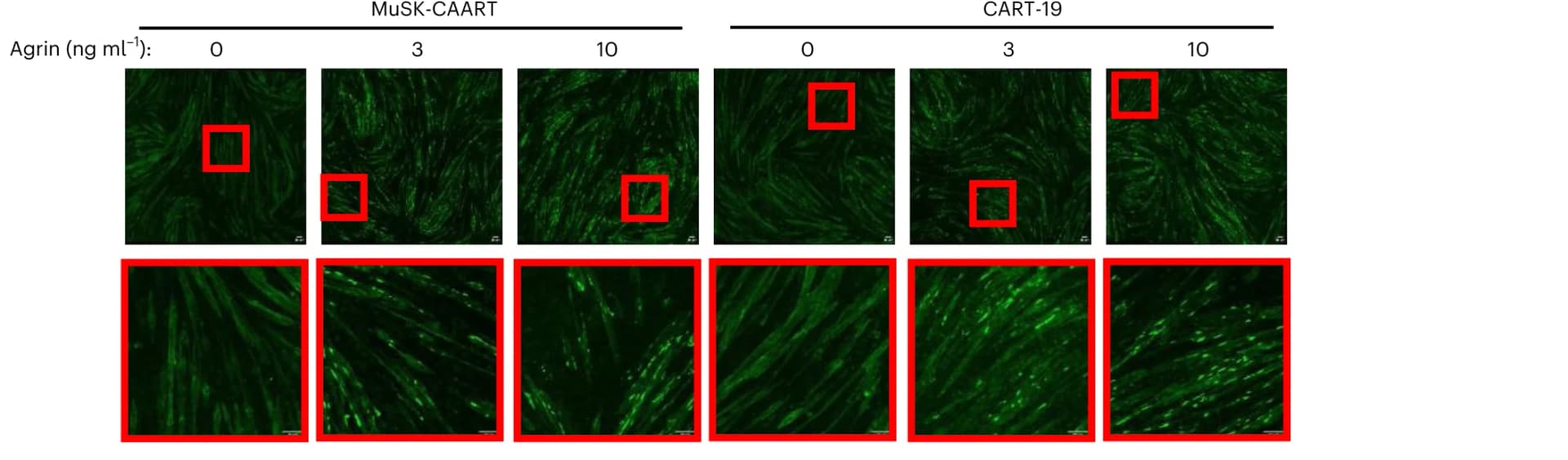 Open access visualization of Microscopy, Photo, MuSK-CAART, CART-19, Agrin