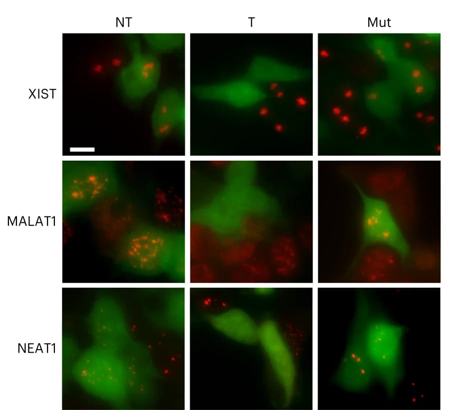 Open access visualization of Microscopy, RNA FISH, HEK293T Cells, crRNA, Cas/Csm Proteins