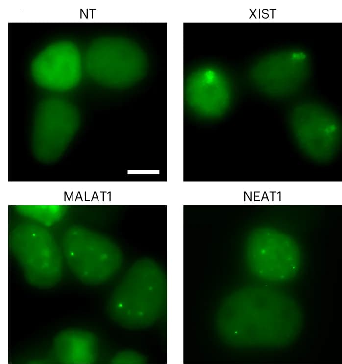 Open access visualization of Microscopy, Live-cell imaging, HEK293T Cells, Csm3-GFP, crRNAs