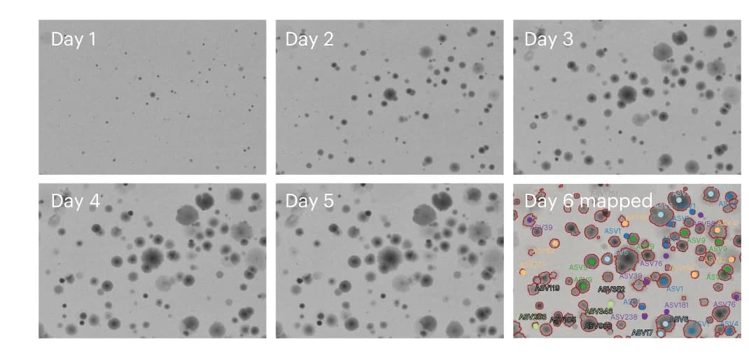 Open access visualization of Microscopy, Plate, Colony, 16S sequencing