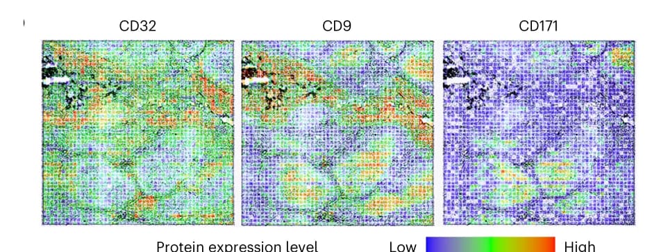 Open access visualization of Heatmap, Protein Markers, Immune Cells, Plasma Cell Precursors, Neural Cell Adhesion Molecule