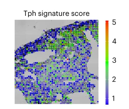 Open access visualization of Heatmap, Spatial Distribution, Tph Gene, Cell Localization