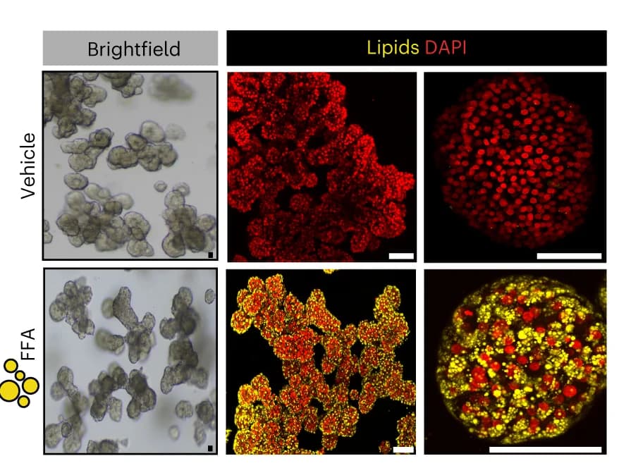 Open access visualization of Microscopy, Brightfield Images, Nile Red Lipid Staining, FFA-exposed, WT Organoids