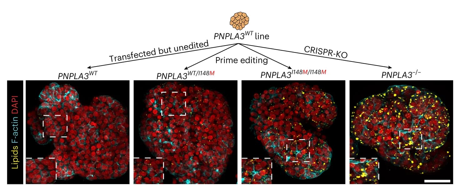 Open access visualization of Microscopy, Workflow, Nile Red Lipid Staining, Phalloidin, PNPLA3 Variant Organoids