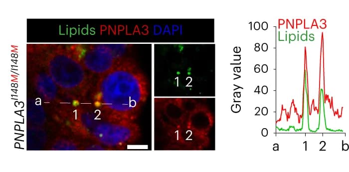 Open access visualization of Line Plot, Microscopy, Immunofluorescence Staining, PNPLA3, Lipid Droplet