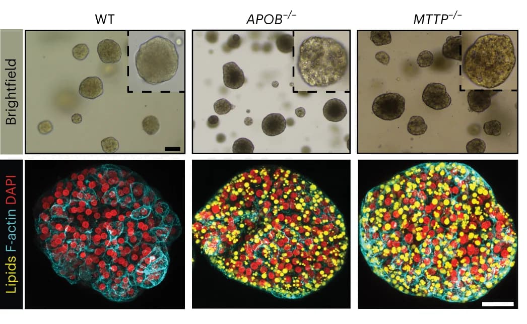 Open access visualization of Microscopy, Brightfield Images, Nile Red Lipid Staining, Phalloidin, WT Organoids