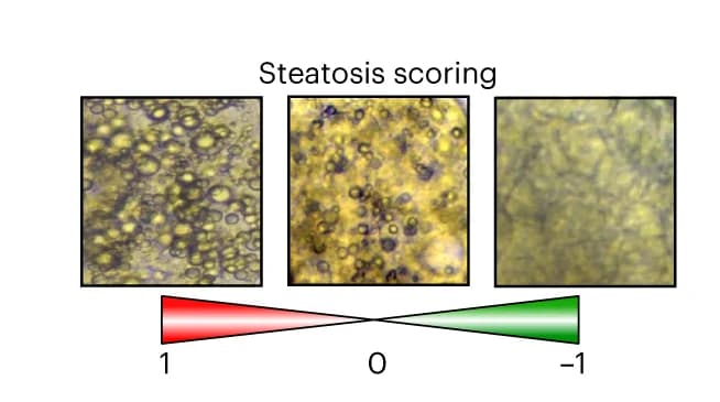 Open access visualization of Microscopy, Brightfield Images, Steatosis Scoring Scale, FatTracer