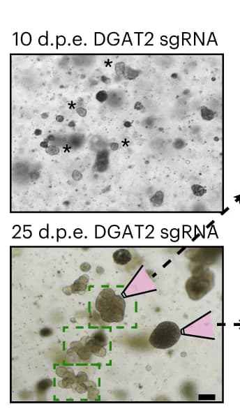 Open access visualization of Microscopy, Photo, Brightfield Images, FatTracer, Organoids