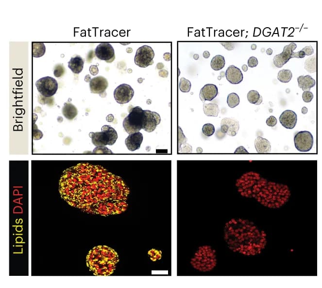 Open access visualization of Microscopy, Brightfield Images, Nile Red Lipid Staining, FatTracer, DGAT2 -/-