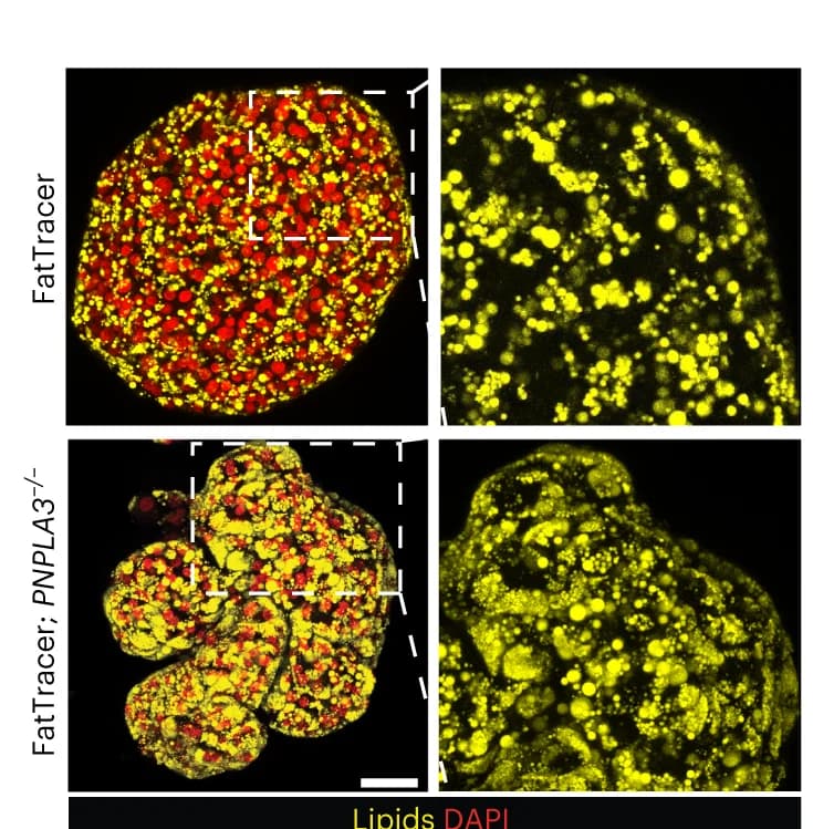 Open access visualization of Microscopy, Nile Red Lipid Staining, FatTracer, PNPLA3 -/-, Organoid Lines