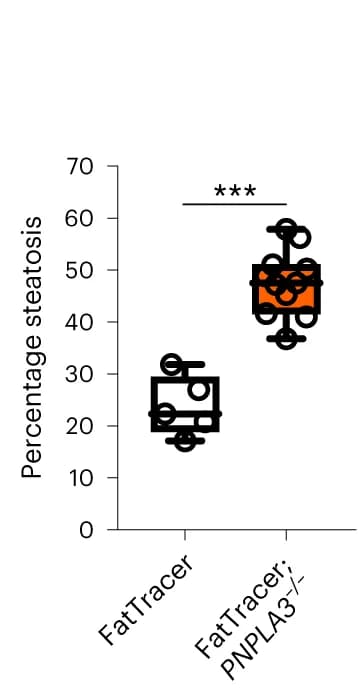 Open access visualization of Box Plot, Scatter Plot, Steatosis Level, Quantification, FatTracer